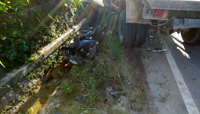 Jupiter MX vs Dump Truk, Syahrul Luka Parah