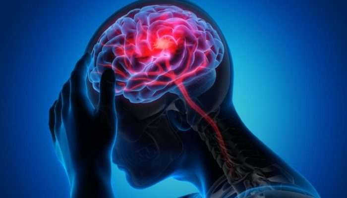 4 Kebiasaan Buruk di Malam Hari Jadi Pemicu Stroke