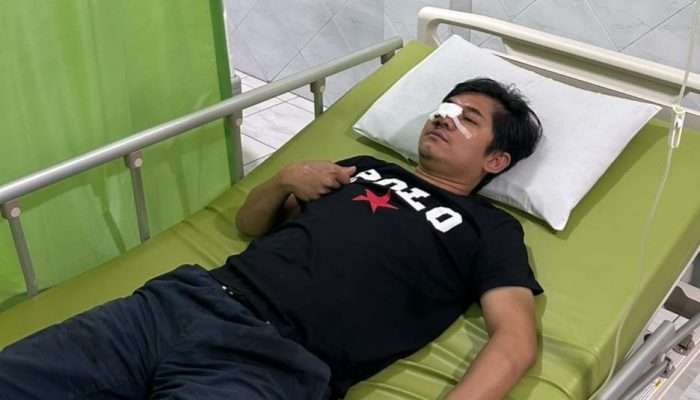 Luka Makin Parah, Wartawan Korban Pengeroyokan di Area PT PMM Dirujuk ke Palembang